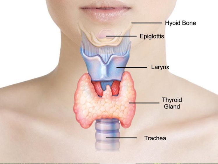 थायराइड ग्रंथि का रोग (hypothyroidism)